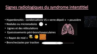 TFR  Différence entre le syndrome alvéolaire et interstitiel à la radiographie [upl. by Akimik]