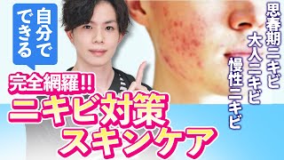 【ニキビ対策スキンケアまとめ】 思春期ニキビ・大人ニキビ・慢性ニキビ…それぞれの解決法を美容専門家が撤退解説！ [upl. by Syverson]