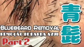 青髭男の髭抜きパート2 Remoção da barba do homem barba azul parte 2 [upl. by Duyne]