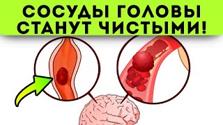 Смотрите что делают старые врачи для чистки сосудов головы Сосуды головы чистят [upl. by Naraa247]