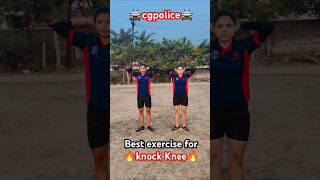 Knock knee💯✅ दूर करें knocknee cgpolice shorts viralshorts viralvedio youtubeshorts ytshorts [upl. by Anoirtac]