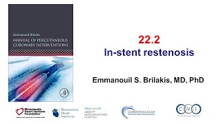 222 Instent restenosis Manual of PCI [upl. by Jezebel]