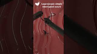 Laparoscopic simple interrupted suture [upl. by Alleusnoc543]