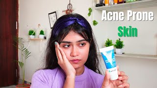 Derma Co 1 Salicylic Acid Gel Facewash Honest Review [upl. by Sarina]