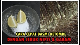 CARA CEPAT MENGHILANGKAN KETOMBE DI KEPALA [upl. by Ahsatniuq]