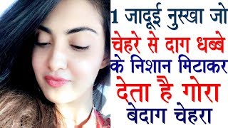 1 इकलौता आसान जादुई नुस्खा जो Chehre ke jiddi daag dhabbe door karke Get clearfair skin [upl. by Yraeht]