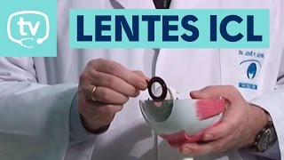 Lentes ICL una solución para corregir miopía hipermetropía y astigmatismo [upl. by Noraa]