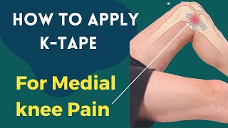 How to treat Knee Pain  Medial Collateral Ligament MCL  Kinesiology taping [upl. by Ladnyk275]