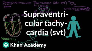 Supraventricular tachycardia SVT  Circulatory System and Disease  NCLEXRN  Khan Academy [upl. by Yesiad]