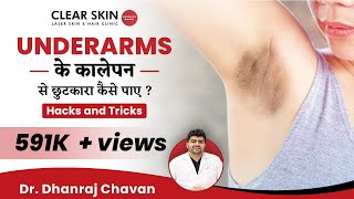 How To Get Rid Of Dark UnderarmsUnderarms के कालेपन से छुटकारा कैसे पाएClearSkin PuneIn HINDI [upl. by Dabney749]