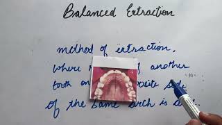 Orthodontic Extractions  Balanced Vs Compensatory Extractions [upl. by Shugart]