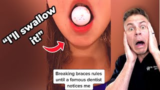 Girl Swallows A WHOLE Jaw Breaker Orthodontist Reacts [upl. by Nabe]