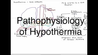 Hypothermia Pathophysiology [upl. by Eenhat]