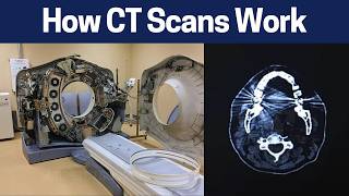 How A CT Scan Works  Principles in Radiology Computed Tomography [upl. by Remos623]