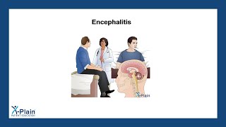 Encephalitis [upl. by Keary373]