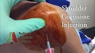 HOW TO GIVE IM INJECTIONS  sites considerations nursing care for nurses [upl. by Oiratno]