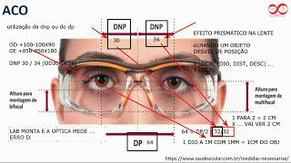 Pilula Óptica 35  Dp ou Dnp [upl. by Nrehtac]