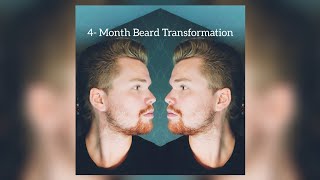 Beard Timelapse  4 Month Patchy Beard Growth [upl. by Rasaec]