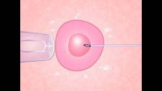 Fertilização in vitro O Passo a Passo [upl. by Tolley]