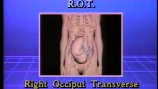 Medical Videos  Fetal lie and presentations  Obstetrics and Gynecology [upl. by Furlani]