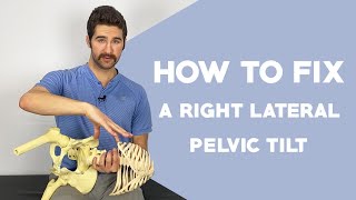 Right Lateral Pelvic Tilt Correction EASY 5Step Guide NOT the opposite of the left [upl. by Auqemahs148]