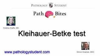 Path Bites  KleihauerBetke test [upl. by Bagley]