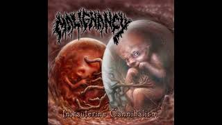 Malignancy  Intrauterine Cannibalism ReRecorded Full Album [upl. by Mohun]