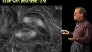 Meiosis II  Richard McIntosh CU Boulder [upl. by Charla]