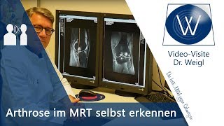 Knieschmerzen Knieverletzung amp Kniearthrose im MRT  Diagnose Arthrose Kreuzbandriss Meniskus [upl. by Longley]