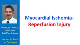 Myocardial IschemiaReperfusion Injury [upl. by Dnomyar]