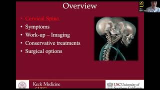 Cervical Disc Disorders with Radiculopathy and Surgical Options  Traumatic Spinal Cord Injury [upl. by Sato]