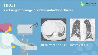 Untersuchungen bei Lungenfibrose bei rheumatoider Arthritis Expertin erklärt [upl. by Noni]