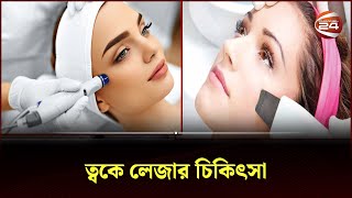 লেজার চিকিৎসার সুবিধাঅসুবিধা  Channel 24  Laser Treatment [upl. by Duer]