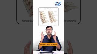 DocTutorials Daily Dose  Klippel Feil Syndrome The Hidden Triad  Dr Rohith Daniel  Orthopaedics [upl. by Anuat225]