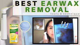 Best DIY Ear Wax Removal at Home [upl. by Enyleve]