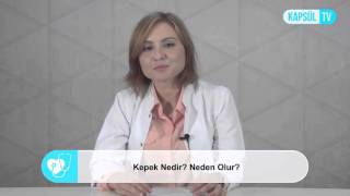 Kepek Nedir Neden Olur [upl. by Bernetta]