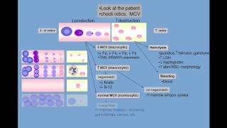 Anemia differential diagnosis [upl. by Liuka554]