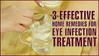 3 Easy amp Effective Home Remedies For EYE INFECTION TREATMENT [upl. by Swope]