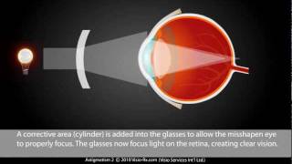 Astigmatism explained Easily Corrected With A Cylinder in Your Eyewear Glasses [upl. by Libbey8]