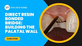 Direct Resin Bonded Bridge Course Preview  Building the Palatal Wall  Dental Online Training [upl. by Ymas483]