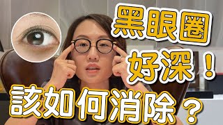 大家常常在問的黑眼圈可以怎麼治療？讓莊盈彥醫師來告訴你！ [upl. by Peedsaj]