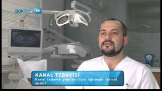 Kanal tedavisi yapılan dişin ağrıması normal midir [upl. by Mandle]