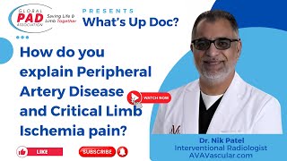 How To Explain Debilitating Peripheral Artery Disease Pain  Dr [upl. by Kone]