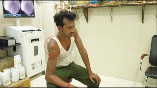 Puttur kattu Shoulder Dislocation Treatment Tamil [upl. by Charters]