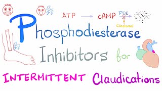 Intermittent Claudications Management [upl. by Sisenej409]