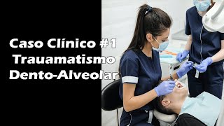 Traumatismo DentoAlveolar  Caso Clínico de Odontologia 1 [upl. by Anelaj]