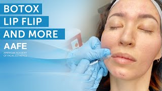 Botox Lip Flip Treatment  More  AAFE [upl. by Nosnaj]