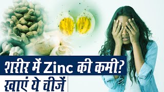 Zinc से भरपूर खाद्य पदार्थ  Best Sources of Zinc  Health Benefits of Zinc [upl. by Ecinrahs586]