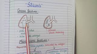 Restrictive Lung Disease  Pathology [upl. by Ylehsa285]