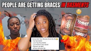 FAKE DENTISTS Are Straightening Teeth In Their Basements 😶 The DIY Braces Saga [upl. by Naitsirc746]